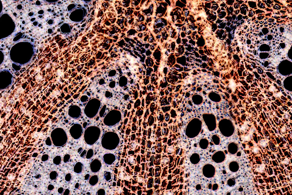 Bild zeigt eine mikroskopische Aufnahme eines Pflanzenstängels, auf der man einzelne Pflanzenzellen erkennen kann.