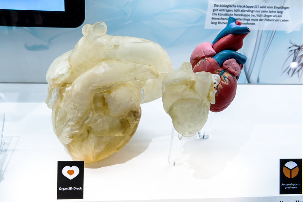 Ein stark vergrößertes Herz neben einem normal großen Herz, beide aus dem 3D-Drucker, daneben ein Herz-Modell zum Vergleich.