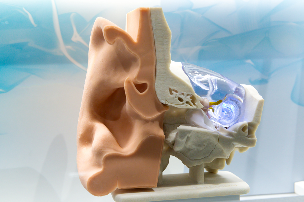 Ein vergrößertes Modell eines Ohrs mit einem eingesetzten Cochleaimplantat.